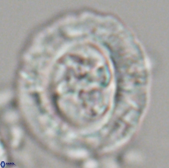 Cruciplacolithus frequens 21177