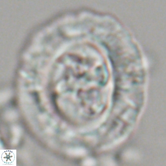 Cruciplacolithus frequens 21177