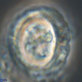 Cruciplacolithus frequens 21178