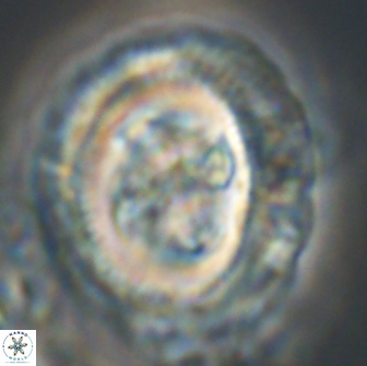 Cruciplacolithus frequens 21178