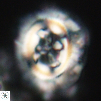 Cruciplacolithus frequens 21172