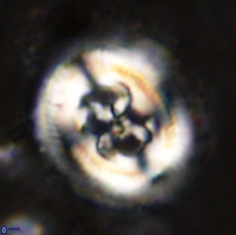 Cruciplacolithus frequens 49804