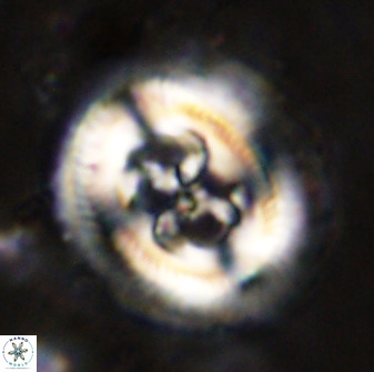 Cruciplacolithus frequens 49804
