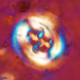 Cruciplacolithus frequens 49805