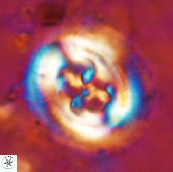 Cruciplacolithus frequens 49805