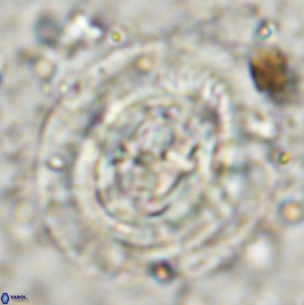 Cruciplacolithus frequens 49806