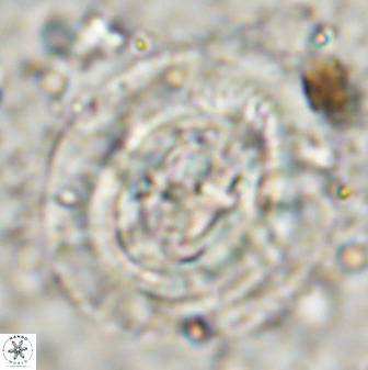Cruciplacolithus frequens 49806
