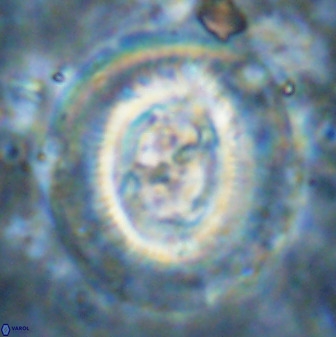 Cruciplacolithus frequens 49807