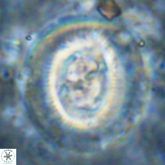 Cruciplacolithus frequens 49807