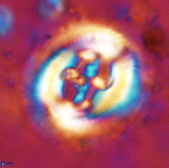 Cruciplacolithus frequens 49801