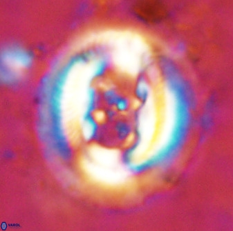 Cruciplacolithus frequens 49802