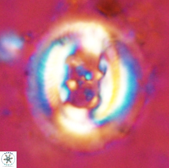 Cruciplacolithus frequens 49802
