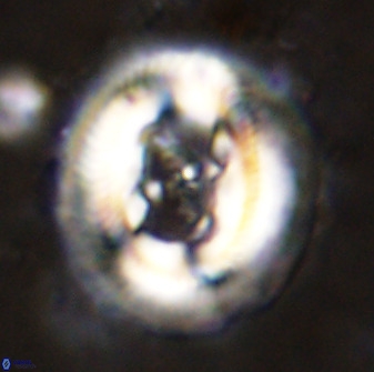 Cruciplacolithus frequens 49803