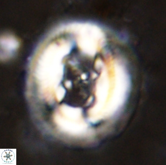 Cruciplacolithus frequens 49803