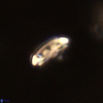 Cruciplacolithus intermedius VR 01345