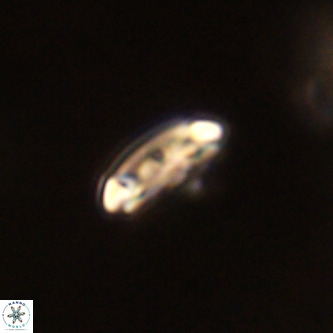 Cruciplacolithus intermedius VR 01345