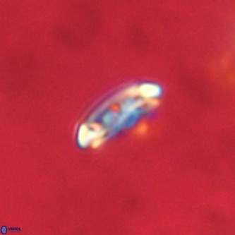 Cruciplacolithus intermedius VR 01346