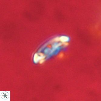 Cruciplacolithus intermedius VR 01346