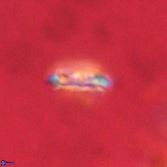 Cruciplacolithus intermedius VR 01342