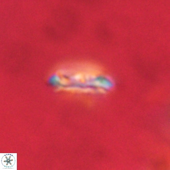 Cruciplacolithus intermedius VR 01342