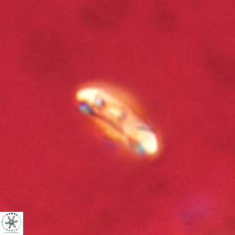 Cruciplacolithus intermedius VR 01343