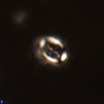 Cruciplacolithus intermedius VR 01355