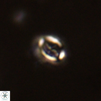 Cruciplacolithus intermedius VR 01355