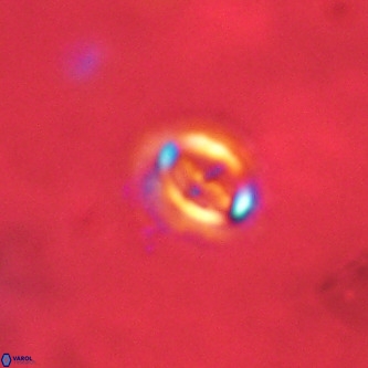 Cruciplacolithus intermedius VR 01356