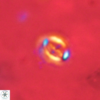 Cruciplacolithus intermedius VR 01356