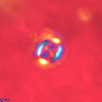 Cruciplacolithus intermedius VR 01357