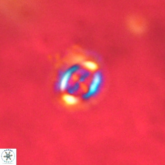 Cruciplacolithus intermedius VR 01357