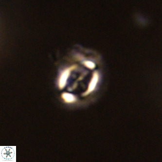 Cruciplacolithus intermedius VR 01359