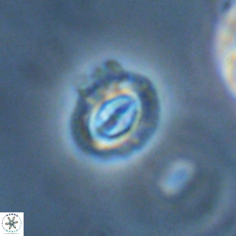 Cruciplacolithus intermedius VR 01367