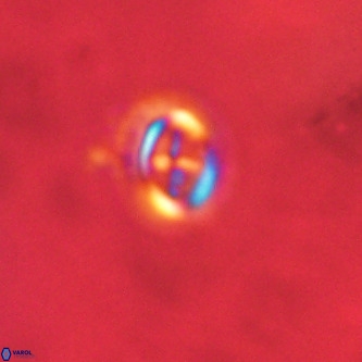 Cruciplacolithus intermedius VR 01361