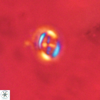 Cruciplacolithus intermedius VR 01361