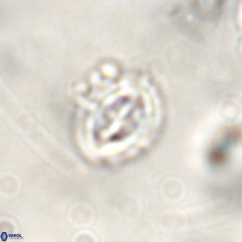 Cruciplacolithus intermedius VR 01363