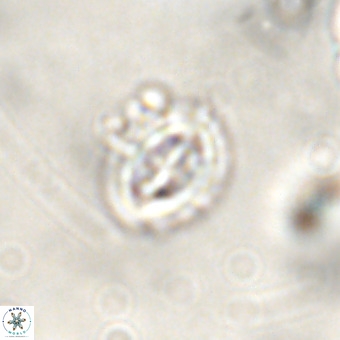 Cruciplacolithus intermedius VR 01363