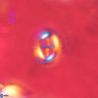 Cruciplacolithus intermedius VR 01371