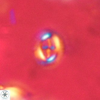 Cruciplacolithus intermedius VR 01371