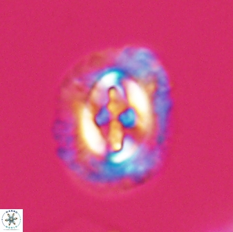 Cruciplacolithus intermedius 22837