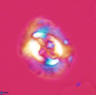 Cruciplacolithus intermedius 22839