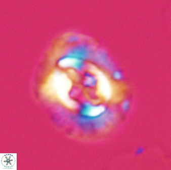 Cruciplacolithus intermedius 22839