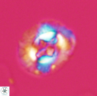 Cruciplacolithus intermedius 22840