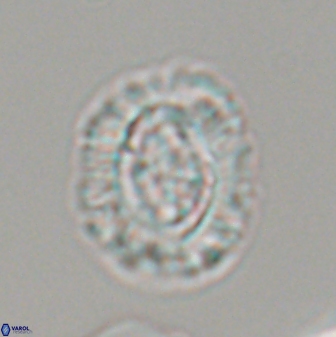 Cruciplacolithus intermedius 22842