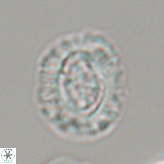 Cruciplacolithus intermedius 22842