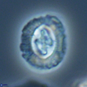 Cruciplacolithus intermedius 22843