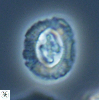 Cruciplacolithus intermedius 22843