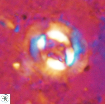 Cruciplacolithus intermedius 49955