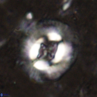 Cruciplacolithus intermedius 49958