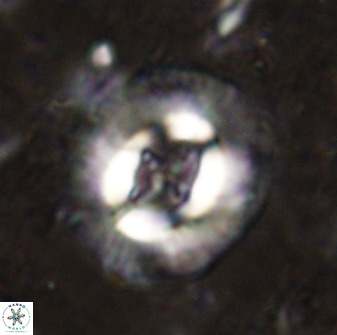 Cruciplacolithus intermedius 49958